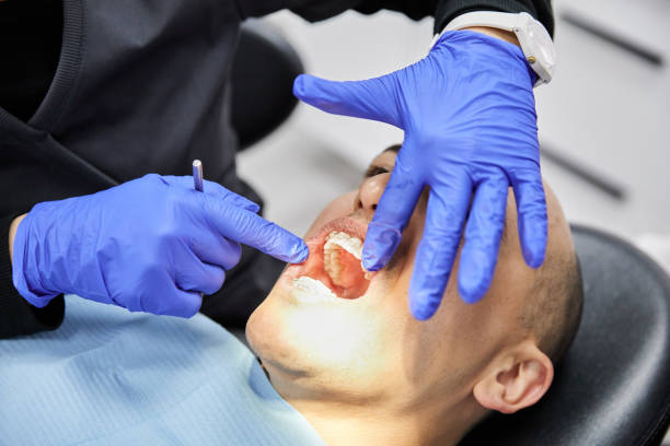 Best Knocked-Out Tooth Emergency  in Luling, LA