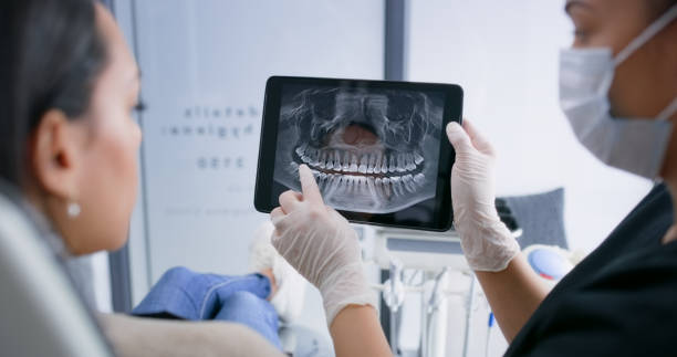 Teeth Whitening in LA